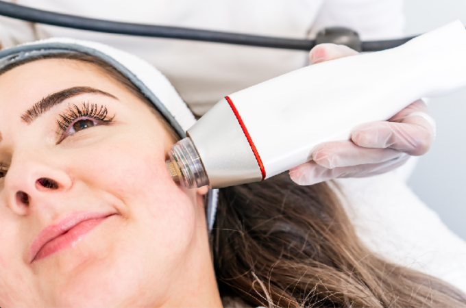 A Complete Guide to RF Microneedling
