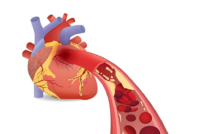 Problems with the Heart: Symptoms of Heart Blockage