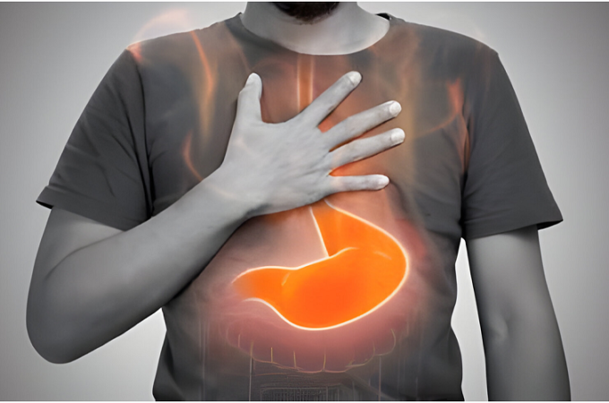 7 Common Symptoms of Gastritis in Your Stomach