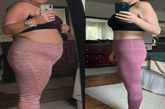 Rapid Weight Loss: What Works and What to Watch Out For