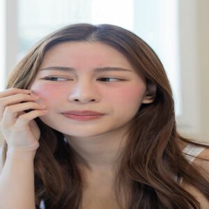 Treating Sensitive Skin