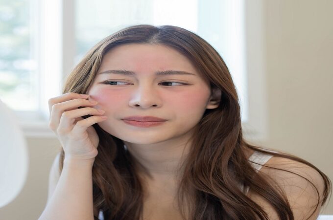 Treating Sensitive Skin