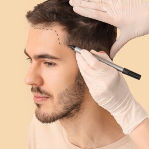 best hair transplant in Turkey