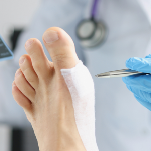 Placental Allografts