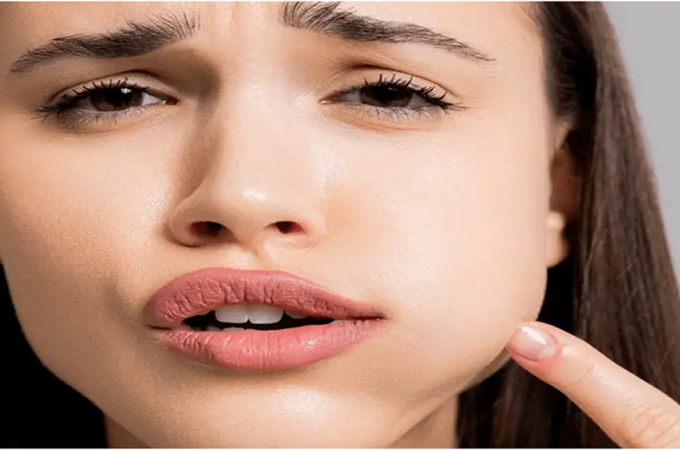 Chipped Tooth? When to Visit a Cosmetic Emergency Dentist in Los Angeles